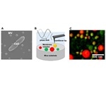 Physical properties of extracellular bacterial membrane vesicles are significantly diverse