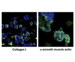 Researchers develop 3D cultured cells that mimic liver fibrosis