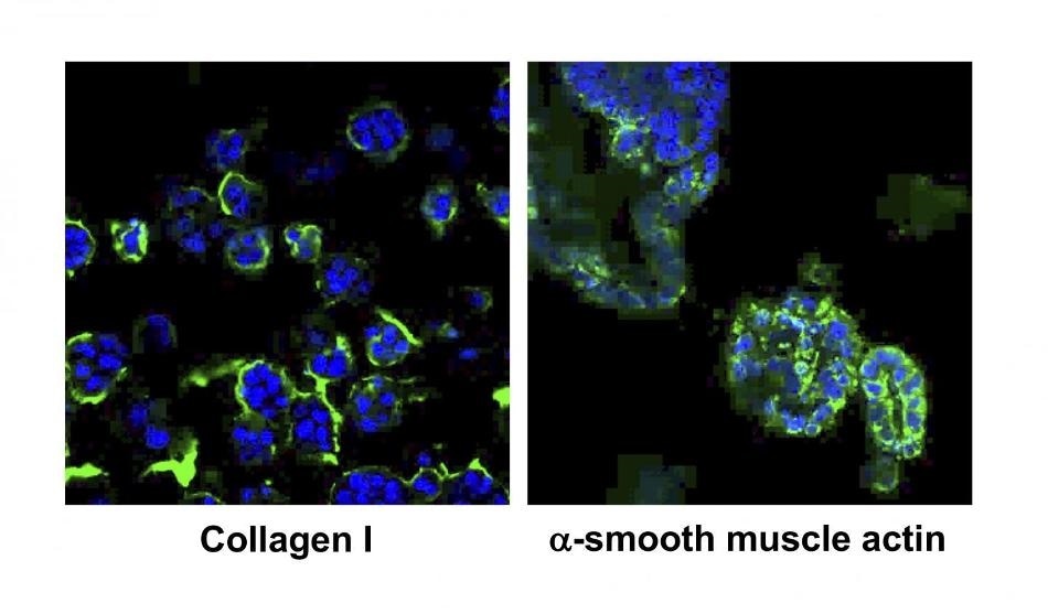 Researchers develop 3D cultured cells that mimic liver fibrosis