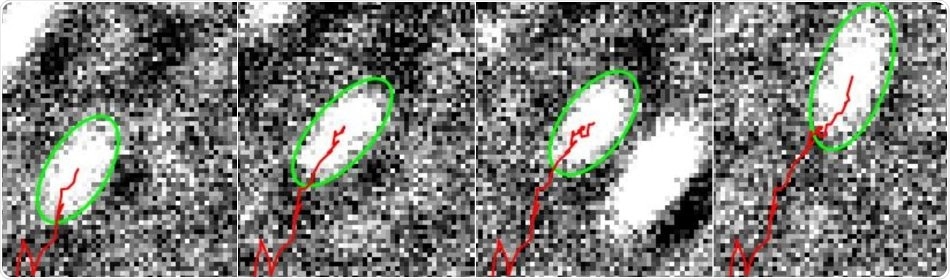 New microscopy technique reveals movements of cell muscles in unprecedented detail