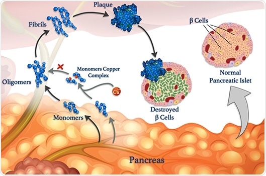 Metals can affect the formation of harmful misfolded peptide clusters in various diseases