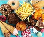 Specialized Nerve Cells Increase The Appetite For High-Fat Foods