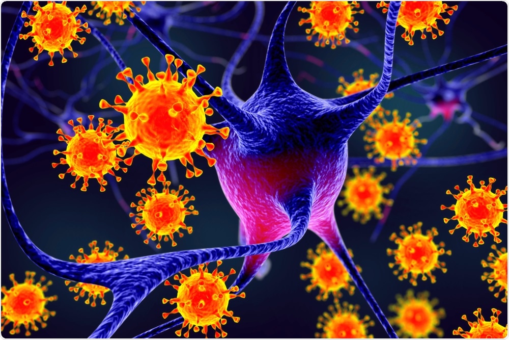 Virus affecting Neurons Virus affecting Neurons