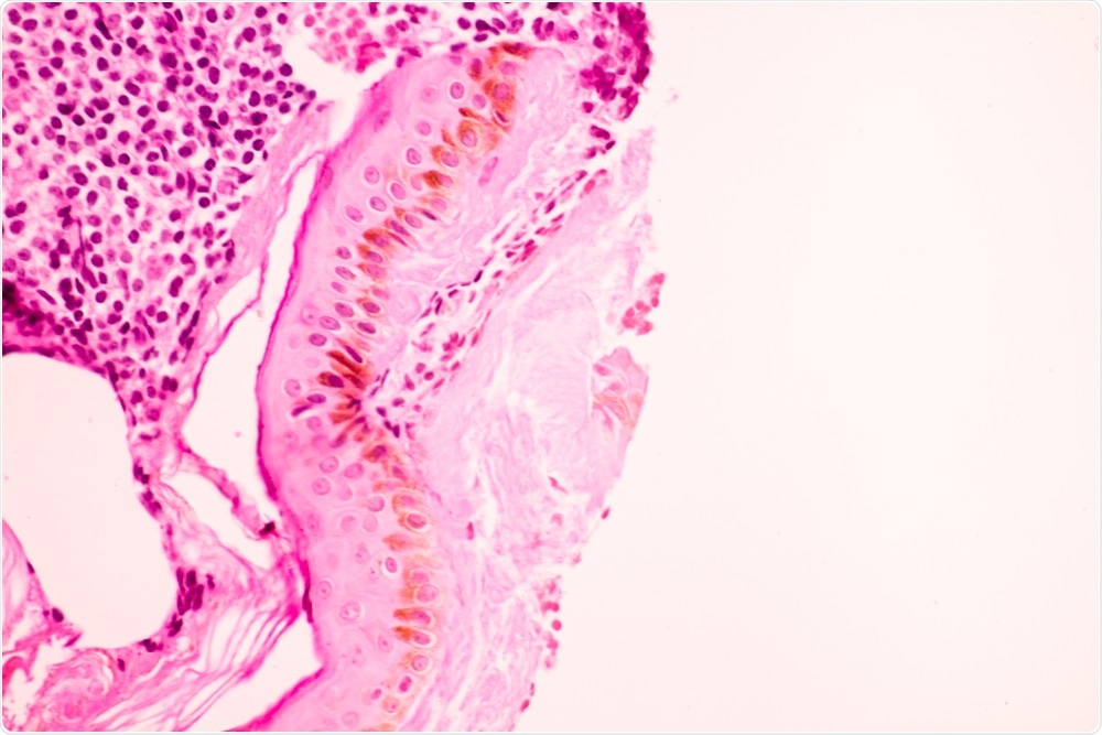 Breast Tissue Breast Tissue