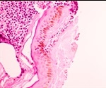 New Type Of Immune Cell Discovered In Breast Ducts