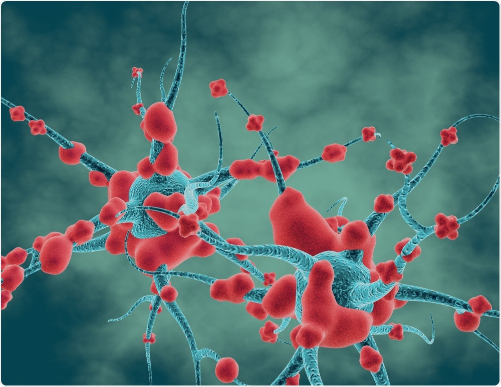 Neurodegenerative Disease Neurodegenerative Disease