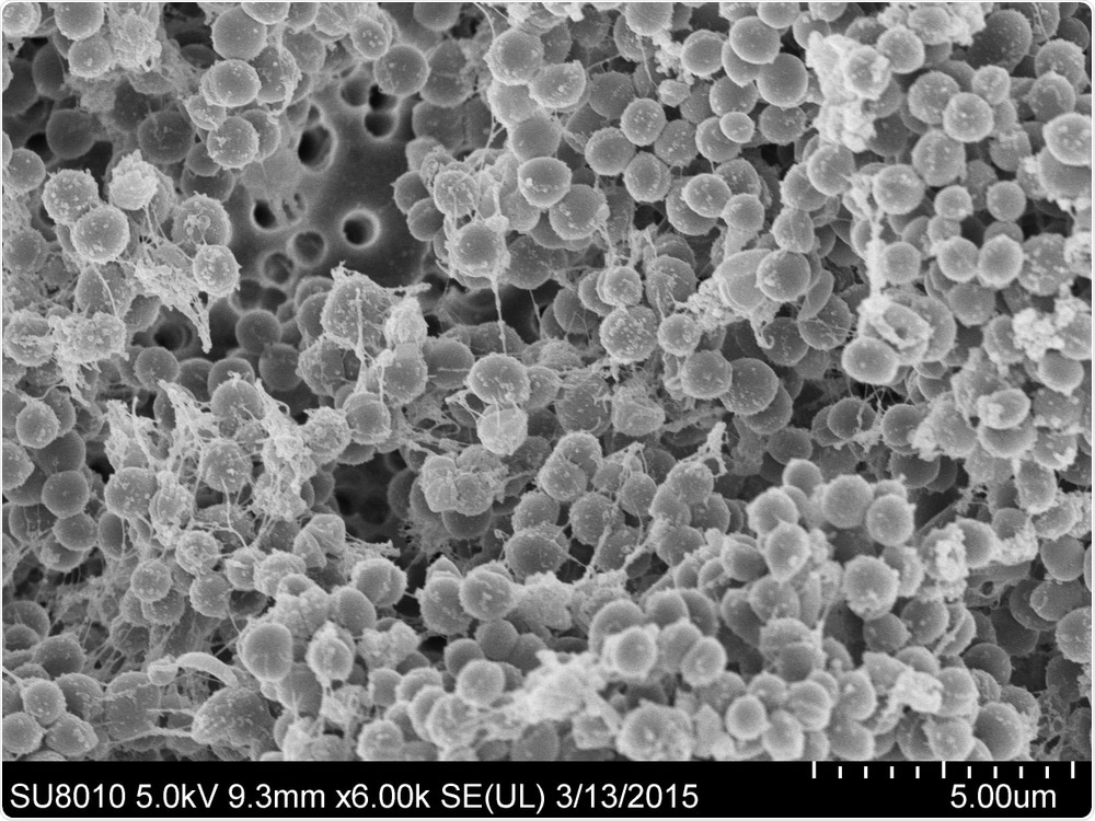 Electron Microscopy Electron Microscopy