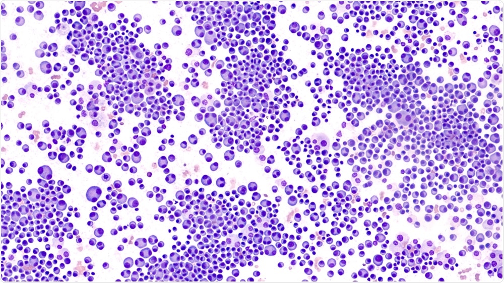 Multiple Myeloma Multiple Myeloma