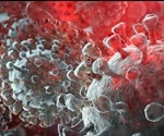 Genetic variability of immune system affects severity of COVID-19