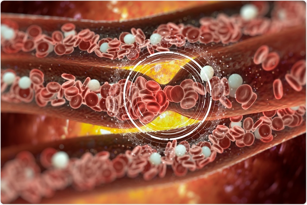 Blood Clot Blood Clot