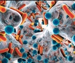 Using Artificial Intelligence to Discover New Antibiotics