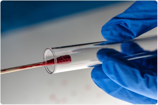 DNA Sample at Crime Scene