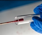 What is Forensic Epigenetics?