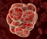 A groundbreaking tool for efficient lipid analysis