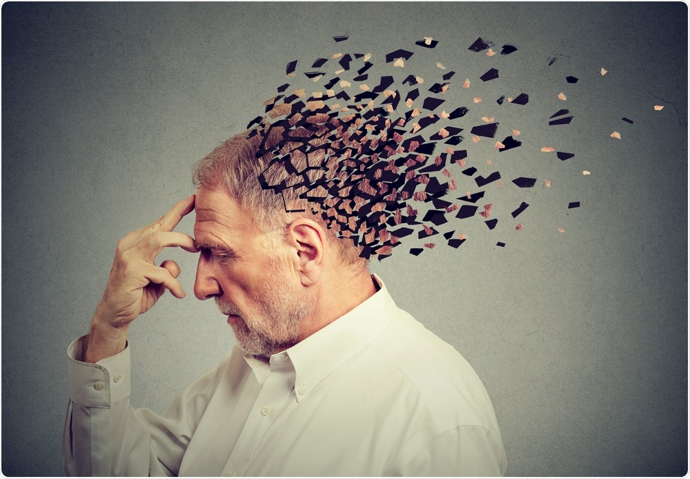 Alzheimers Disease Alzheimers Disease