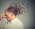 Discovery Of New Biomarker In Blood Could Lead To Early Test For Alzheimer's Disease