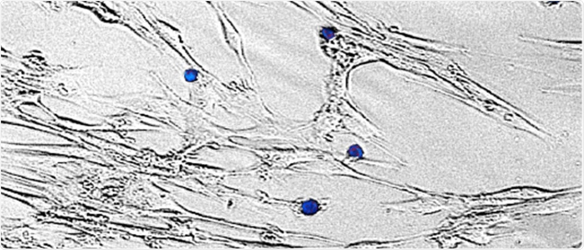 mTOR gene in GvHD patients regulates cell growth and cell survival
