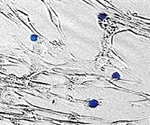 mTOR gene in GvHD patients regulates cell growth and cell survival