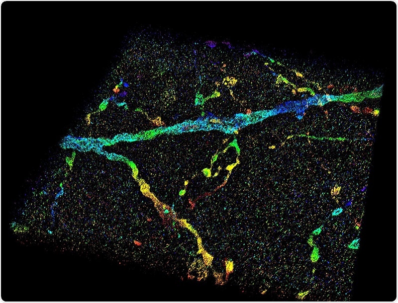 New tool may shed more light on neurodegenerative diseases