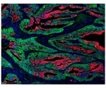 Biosynthetic capacity allows cancer stem cells to contribute to tumor growth