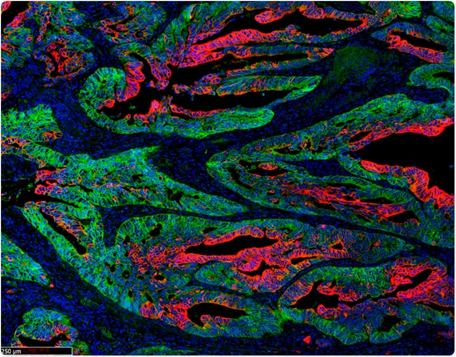 Biosynthetic capacity allows cancer stem cells to contribute to tumor growth