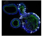 Researchers design novel cell culture model of human intestine to study COVID-19