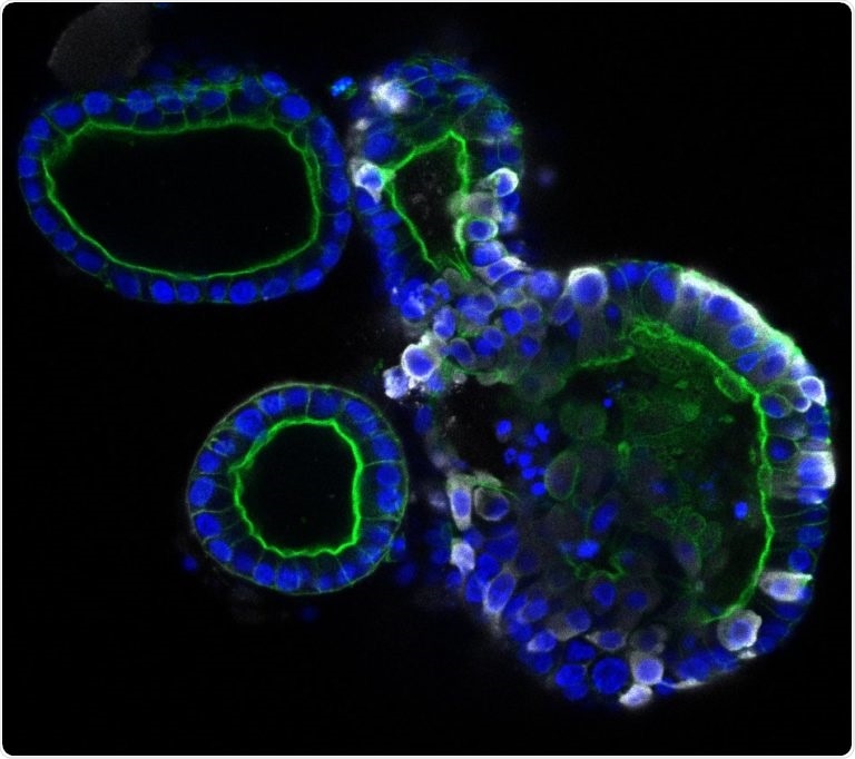 Researchers design novel cell culture model of human intestine to study COVID-19