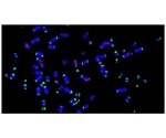 Study reveals proteins that sustain cancer cells