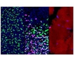 Study could help design better methods to create muscle cells from stem cells