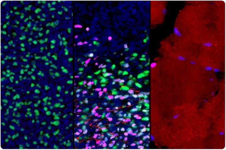 Study could help design better methods to create muscle cells from stem cells
