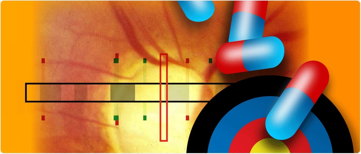 Newly discovered gene variants offer therapeutic possibilities for glaucoma