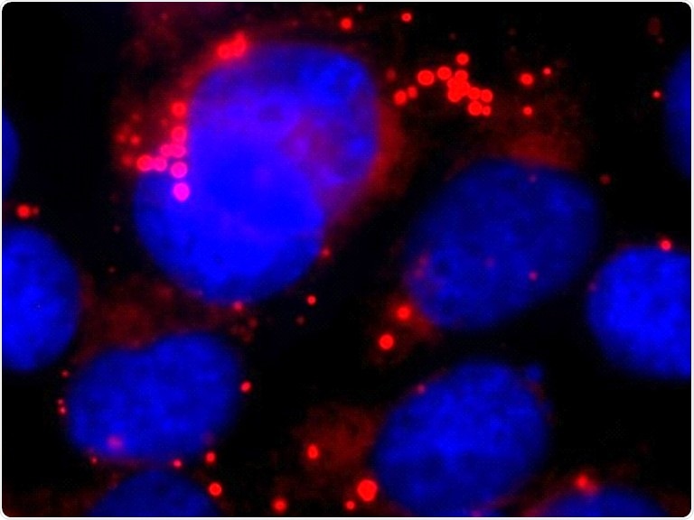Study shows protein shredder also regulates fat metabolism indirectly