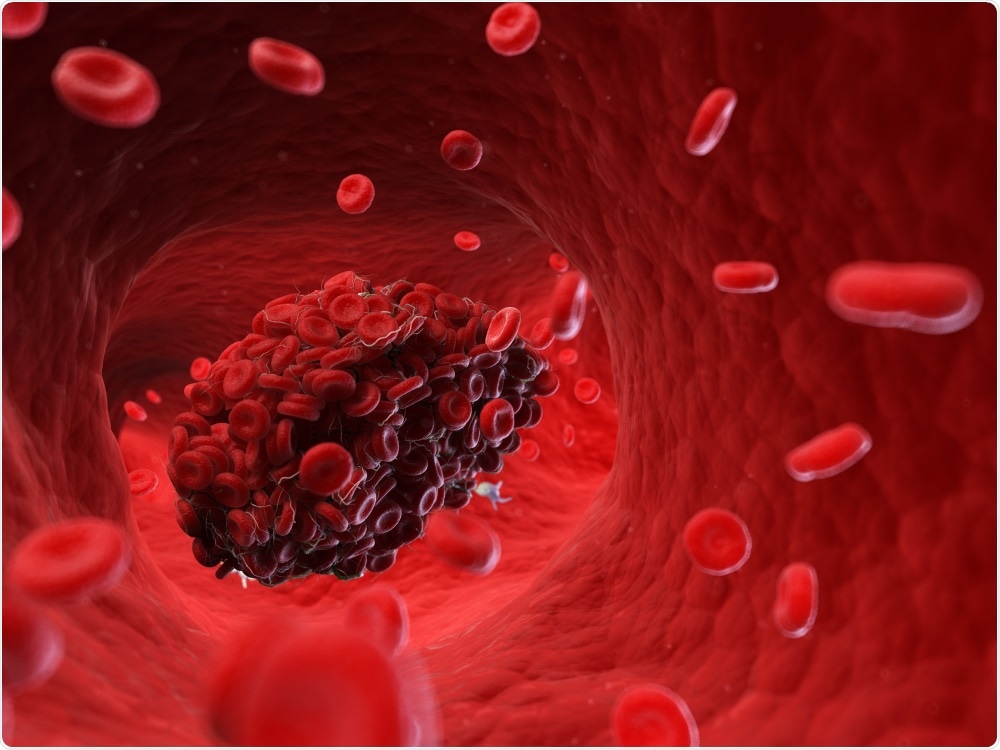 Blood Clot Blood Clot