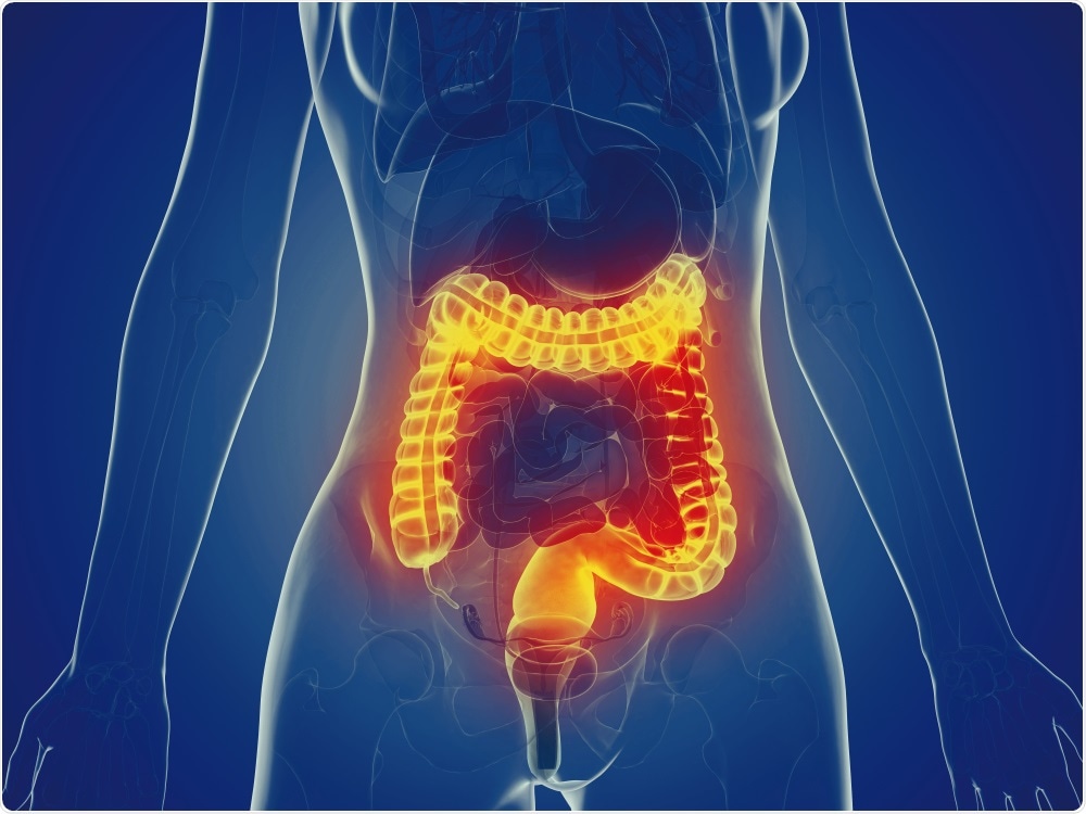 Inflammatory Bowel Disease Inflammatory Bowel Disease