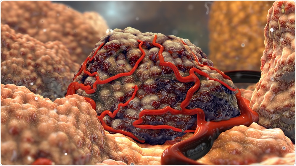 Tumor Cell Tumor Cell