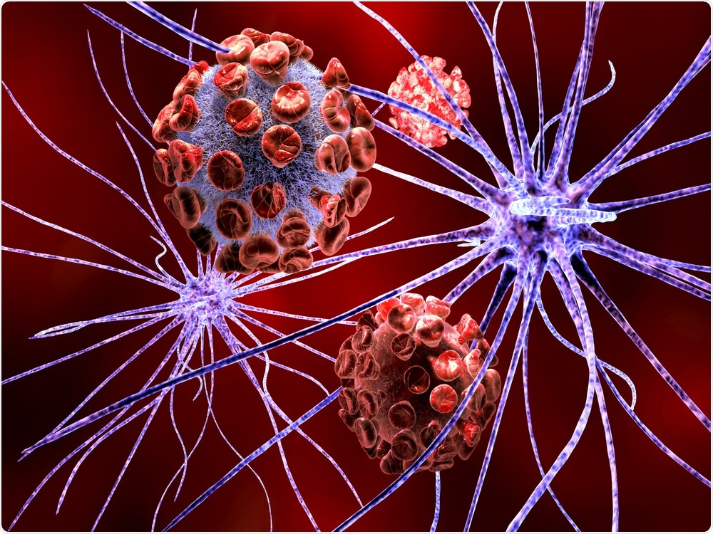 Neurological Disorder Neurological Disorder