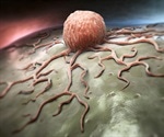 Researchers discover new therapeutic targets for cancer, male infertility