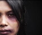 Alternate Light 5 Times More Effective In Detecting Bruises On Victims Of Color