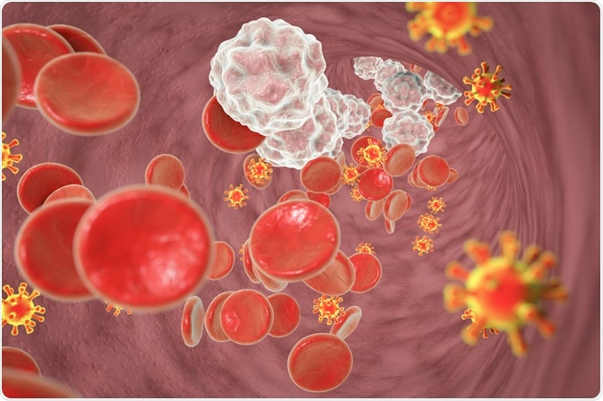 HIV infection HIV infection