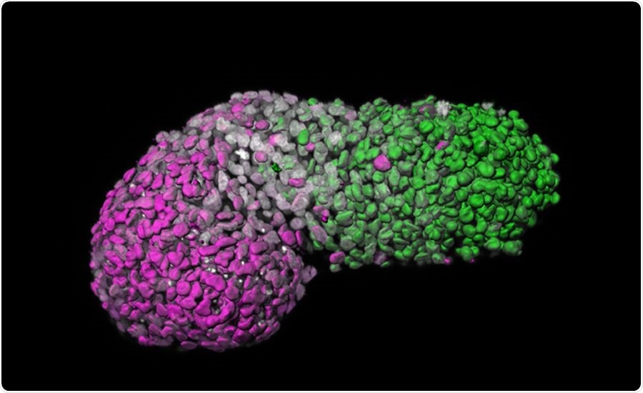 Researchers create a new model to study early stage of human development