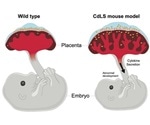 Dysfunctional placenta can contribute to Cornelia de Lange syndrome
