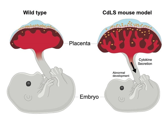 Dysfunctional placenta can contribute to Cornelia de Lange syndrome