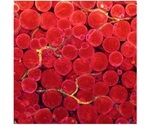Angpt2 hormone can help treat obesity-induced metabolic disorders