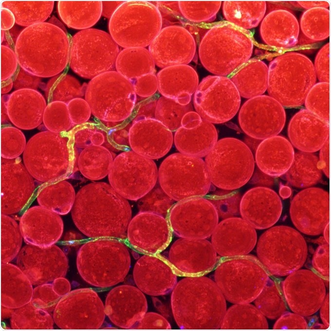 Angpt2 hormone can help treat obesity-induced metabolic disorders