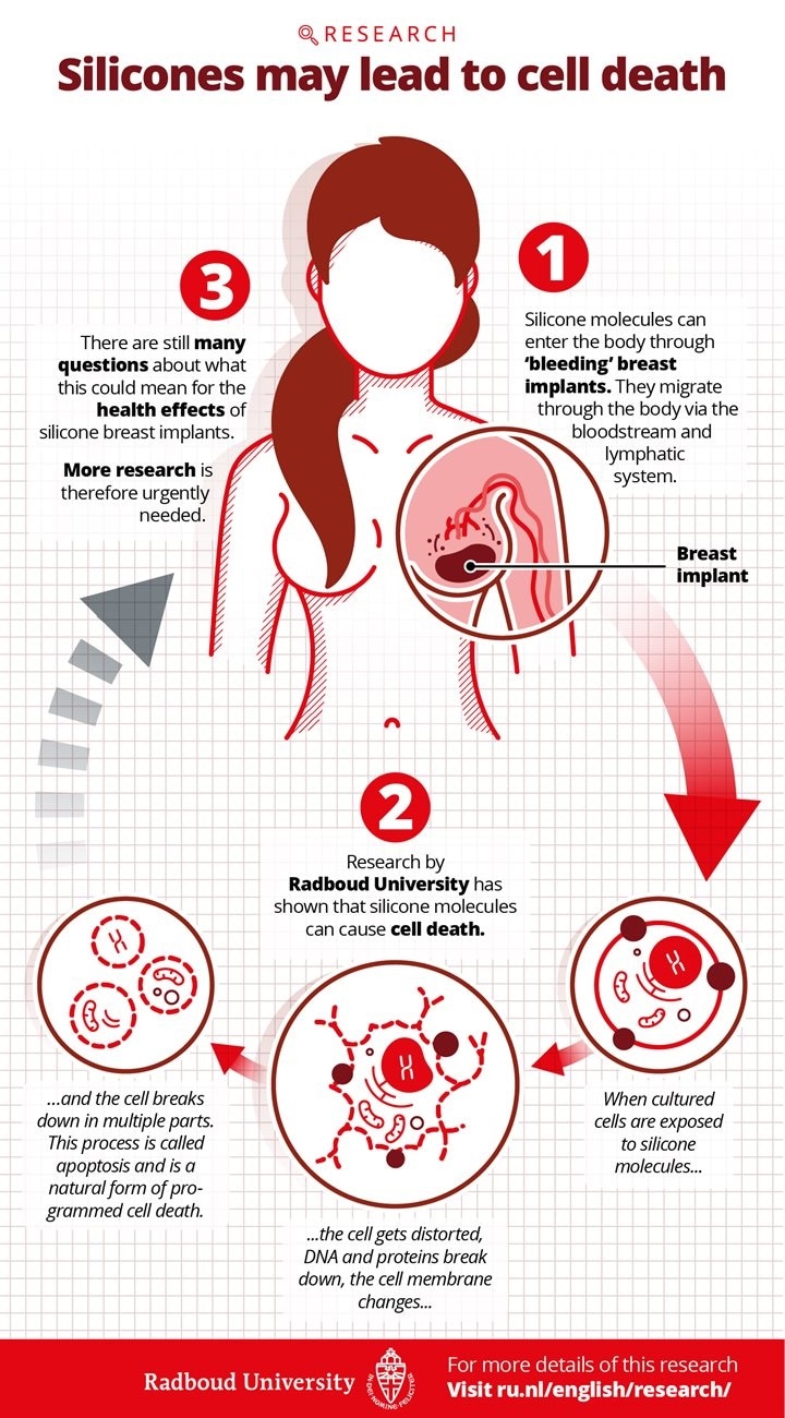 Study reveals the negative effects of silicone breast implants