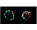 Study provides better understanding of declining T cell immunity in elderly