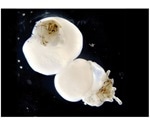 Lab-grown organoids can prevent hair loss