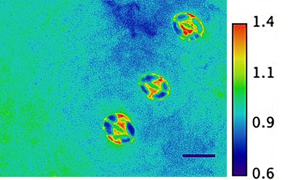Stress nanosensor reveals real-time changes in plant cells