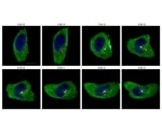 Study sheds light on the complexity of HIV-1 nuclear entry