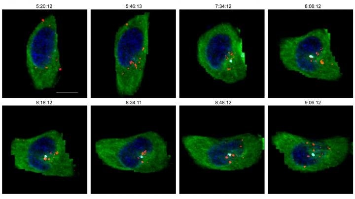 Study sheds light on the complexity of HIV-1 nuclear entry